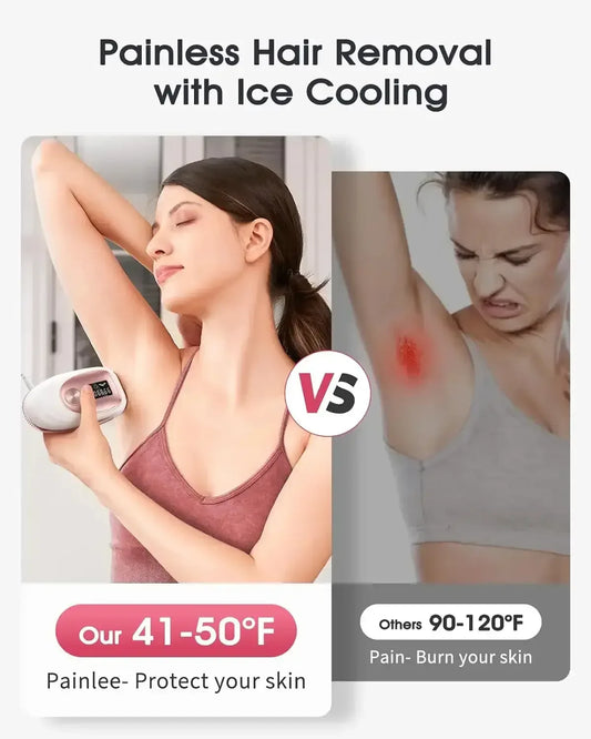 Hair Removal Laser TM002 / US Plug / United States
