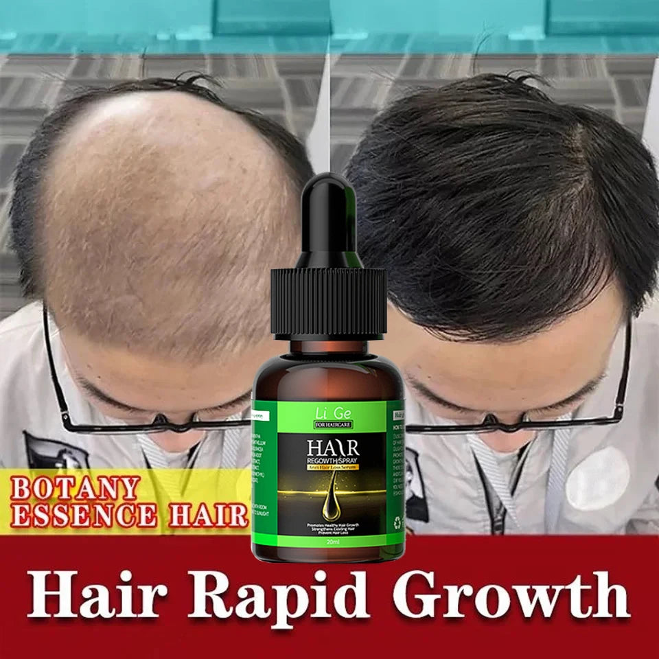 Hair Growth Oil Fast Hair Growth Effective Baldness Repair