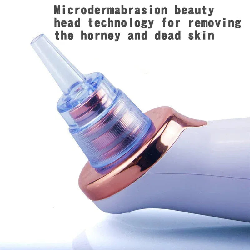 Facial Blackhead Remover Electric Vacuum Machine Default Title