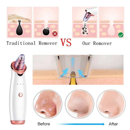 Facial Blackhead Remover Electric Vacuum Machine Default Title