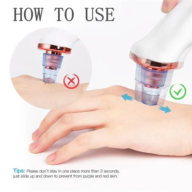 Facial Blackhead Remover Electric Vacuum Machine Default Title