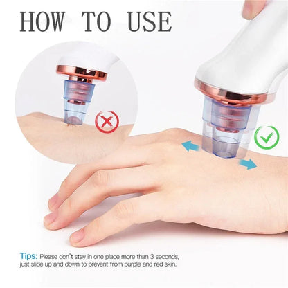 Facial Blackhead Remover Electric Vacuum Machine Default Title