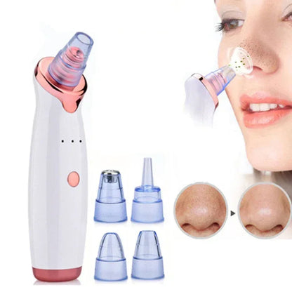 Facial Blackhead Remover Electric Vacuum Machine Default Title